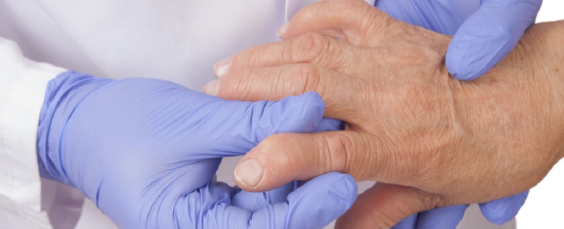 Reumali liigeste ravi ulevaateid Reumatoloogide liigeste ravi