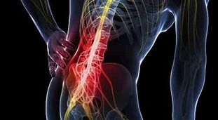 Kuidas eemaldada valu artroosi ajal liigeste artroosi ajal Unustage liigeste haiguste parast