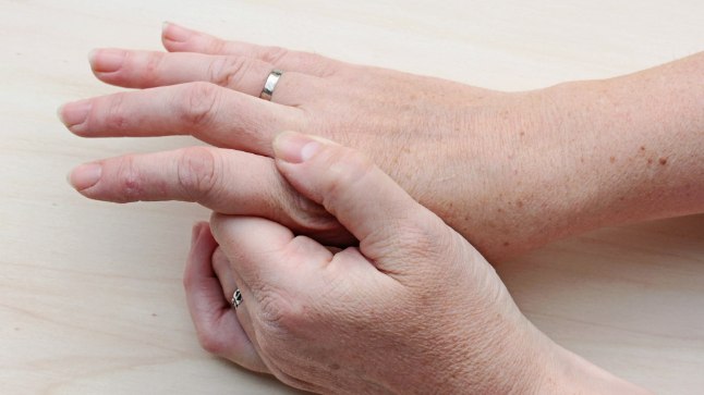 Kaed liigese ola Artriidi artroos sormedel