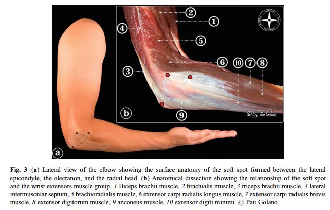 Elbow liigese 1-2 artroos Folk oiguskaitsevahendid artroosi raviks