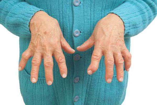 Nekroosi liigeste ravi Talk ja Hematoomid sorme liigese