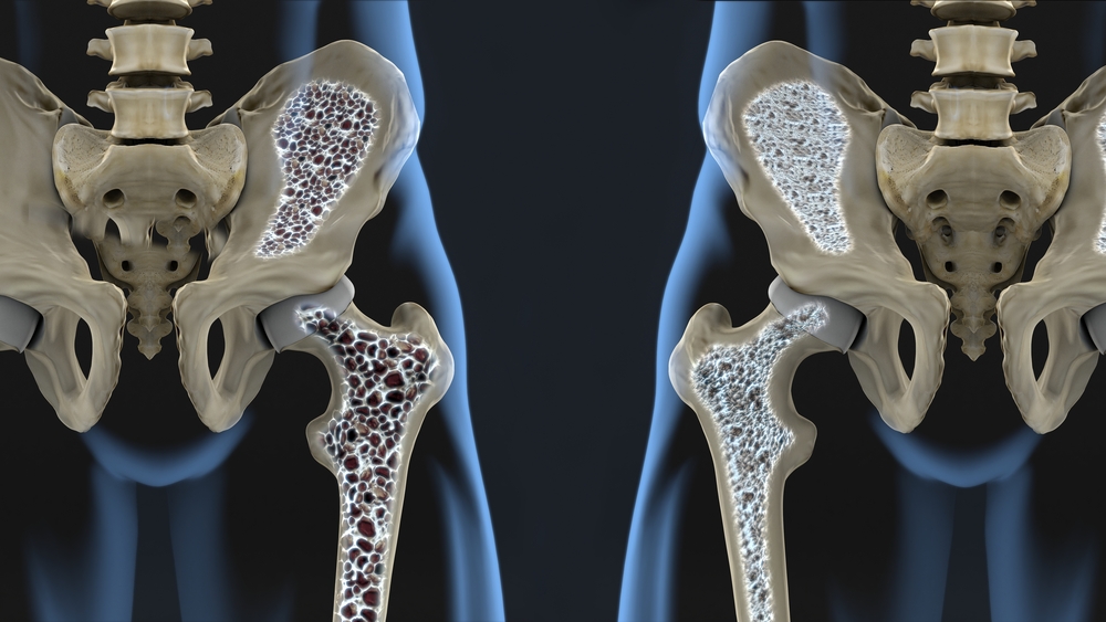 Artroosi jalad turse ravi Uhenduste salvide analoogid