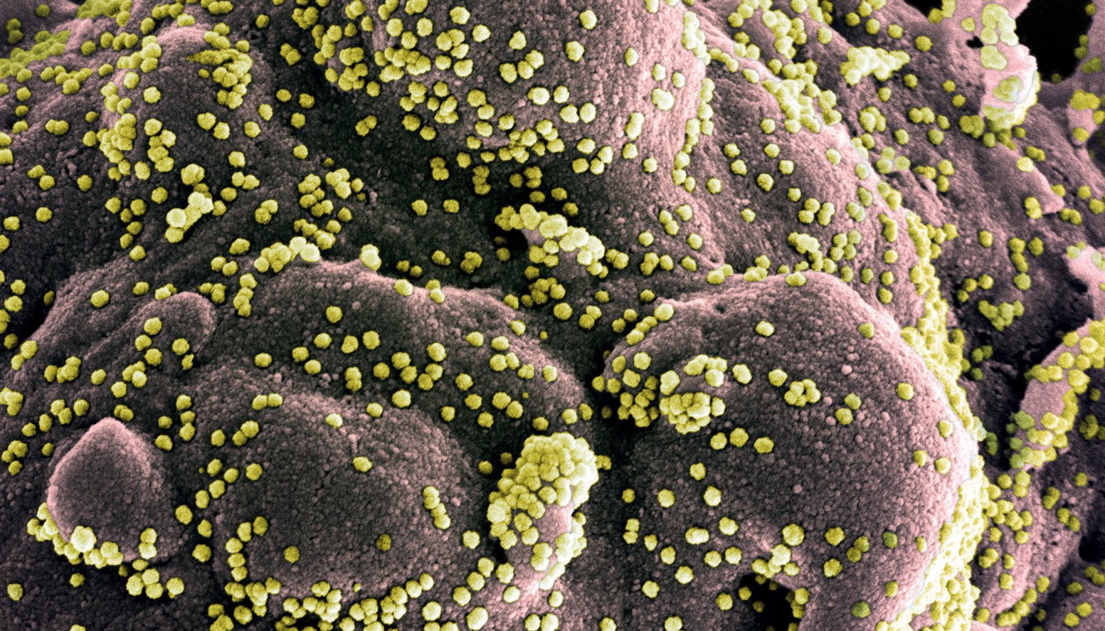 Streptococcus ja liigesevalu Ichthivo salvi liigeste ravi