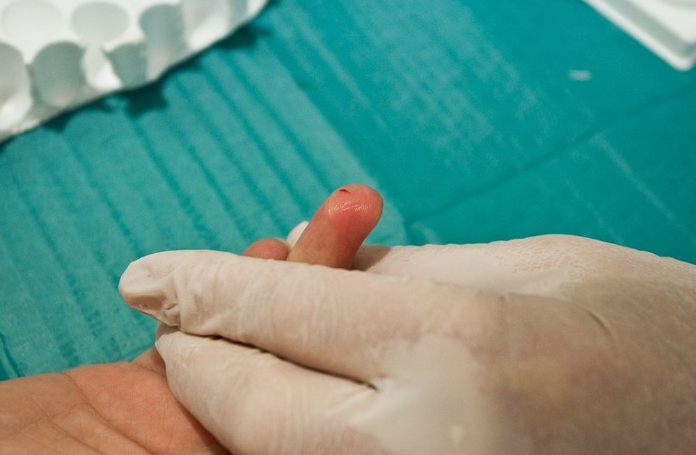 Foot liigeste haiguste ravi Hoidke sormega liigeseid