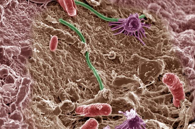 Mis bakterid pohjustavad liigeste haigusi