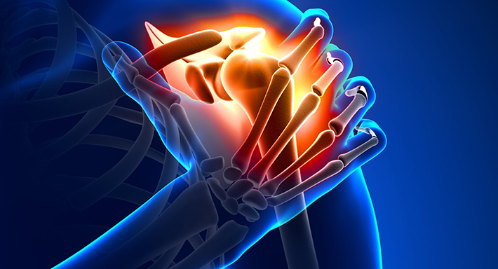 Artriidi artroosi rahvaste ravimite ravi kahjustada pahkluude liigeseid