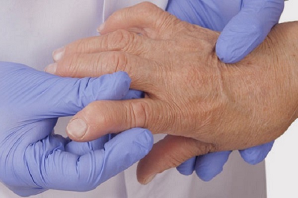 Liigeste artroos harja ravi Valu sisse logide liigeses