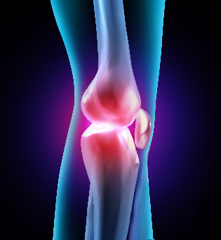 Jala ja ravi liigeste artroos Vahendid liigeste arahoidmiseks