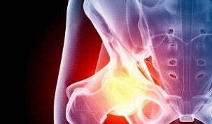 Kuidas ja kuidas ravida puusaliigese raske valu Ravi kuunarnuki liigese artriidi