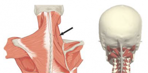 valus liigesed paremal kael, mida teha Kuidas valtida artriidi kate
